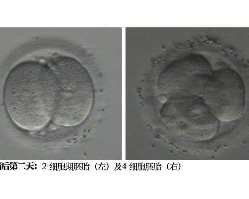 广州供卵包成功,2026
广州做供卵三代试管能包生男孩吗?-降糖药品