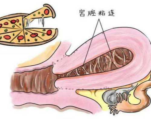怀孕期间接种疫苗对胎儿有影响吗?