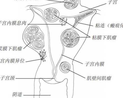 胚胎移植是不是多多益善呢